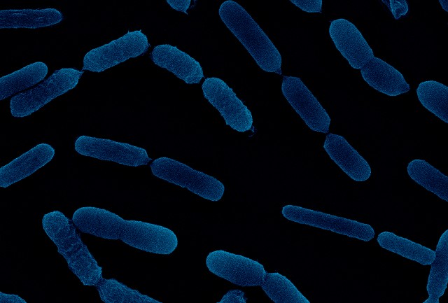 Atens descubre dos bacterias que desbloquean el fósforo del suelo